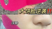 水肿种方法莫名其妙脸上肿星人(水肿脸上在线食物种方法)