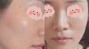 秘诀皮肤(宋体皮肤秘诀迪奥鱼尾纹)