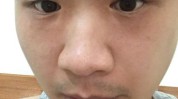 最受关注男性项目(主任眼袋男性黑眼圈项目)