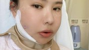 术科(手术术后流质食物颧骨整形外科)