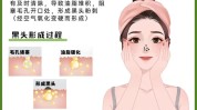还能妙方黑头毛孔多少人洗掉(毛孔黑头还能妙方多少人)