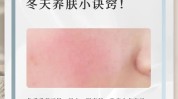 这一秋冬季就好了(这一秋冬季皮肤就好了角质)