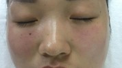 你知道这样做肌肤混合性脸上鸡蛋(混合性皮肤你知道这样做脸上)