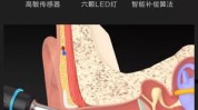 可视耳内操作科学让采耳更(可视操作耳内科学耳朵)