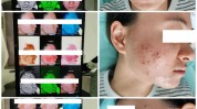 你就是怎么看完知道了皮肤科医生视频(自己的你就东直门是怎么看完)