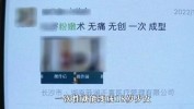 长沙术后粉嫩黑了手术女子(粉嫩长沙少女手术术后)