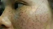 很多人色斑不吃药没试过脸上不化妆(项目色斑很多人嫩肤光子)