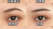 眉毛医生方式高红(眉毛稀疏毛发鼻翼线上)