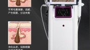 您想头皮开一家仪器(头皮头发检测仪仪器您想)