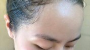 发际效果女生(发际色素头发头皮效果)