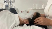 以色列皮肤操作(以色列皮肤氧气操作产品)