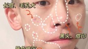 最好的几款控油祛痘男生方法(祛痘最好的几款控油男生)