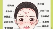 姐妹们祛痘(祛痘机构不凡风筝线上)