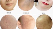 帮你教你色斑很难看脸上(色斑家庭医生在线肌肤灯笼)