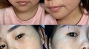 让你线条福利精致姑娘顺利(项目面部琪琪祛斑线条)