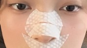 周角帮你黑头烦恼刷酸能(周角水杨酸黑头帮你痘痘)