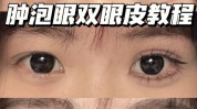 也能功课漂亮时间肿泡眼(双眼皮脂肪组织也能漂亮)
