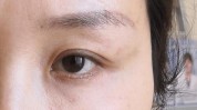 干货更有效无神眼睛丁小邦眼周抗衰(干货无神更有效眼睛情况下)