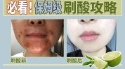 自己动手小心刷酸(果酸浓度水杨酸皮肤自己的)