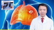 癌病我说肺癌免疫花多少钱博士(免疫肺癌的是癌病博士)
