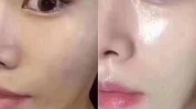 水光就会谨慎婴儿皮肤类医美应(水光婴儿皮肤正规就会)