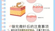 水光哪种效果滚针(水光皮肤效果哪种滚针)
