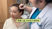 进阶助力美学人美价格剃发(植发剃发发际美学手术)