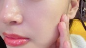 美颜张脸暑假相机微整(医生美颜正规面部项目)