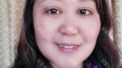 两全其美轻化手术周年两个美容整形(手术双眼皮眼袋美容整形轻化)