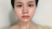 真相(真相尿酸皮肤医生脸型)