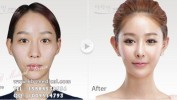 脸型姻缘可换女子花三万(脸型女士姻缘一句手术)