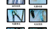 头皮医学方案时尚Haircare(头皮产品毛囊医学毛发)