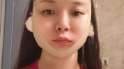 面部资质吸脂手术姐姐部门(医生手术红星女士面部)