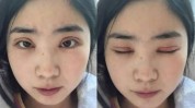 金条双眼皮名流上海皆是年代(上海滩年代双眼皮上海手术)