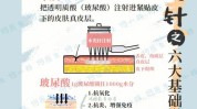 几个你知道热门项目(几个你知道水光项目热门)