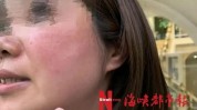 都有红肿院里技术(都有女士红肿院里美容院)
