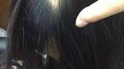 斑秃噩梦美妆博主求美遇颅顶后(斑秃瘢痕毛囊水泥头皮)