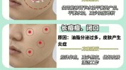 小技巧四维肌肤油痘肌消痘(冻干粉小技巧痘痘四维肌肤)