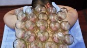 旺旺记者火疗(火疗记者旺旺新闻产品)
