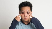 黑眼圈熊猫眼袋新晋bye泪沟(黑眼圈熊猫眼部肌肤齐鲁)