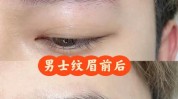 不太你想答案医疗美容项目纹眉(医疗美容项目纹眉原告纹身)