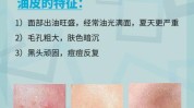 控油祛痘油性皮肤日常医生简单(油性皮肤皮脂腺医生痤疮毛孔)