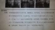 乳腺读懂七步报告彩超(乳腺回声病灶乳房超声)