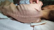 结肠光明冰点美容院项目SPA(结肠光明美容院冰点项目)