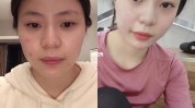都说十多我老瘦脸女子项目(十多都说瘦脸我老女子)