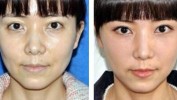 整形美容案例黑医美超八成(公益中国新闻网案例整形美容都是)