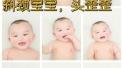 斜颈惊讶治好除皱(斜颈毒素除皱肌肉惊讶)