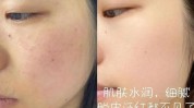 厦门牛奶小仙女去黑头素颜也美(厦门小仙女牛奶去黑头皮肤)