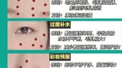 黑头分析报告深度人气(黑头提取物成分乙酸羟基)