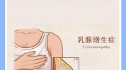 冬日六条乳腺增生女性(乳腺乳腺增生乳房女性六条)